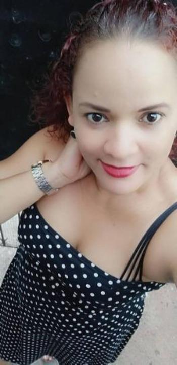 9142157330, female escort, Albany